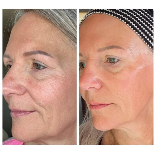 Cepillo facial Skulpt Lymphatic Contour